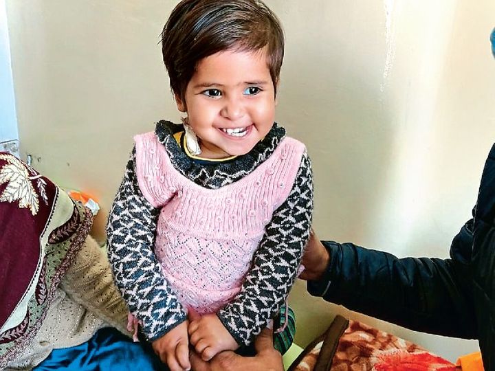 दुनिया में पहला ऑपरेशन:चंडीगढ़ PGI में 16 महीने की बच्ची का ब्रेन ट्यूमर नाक के रास्ते से निकाला गया